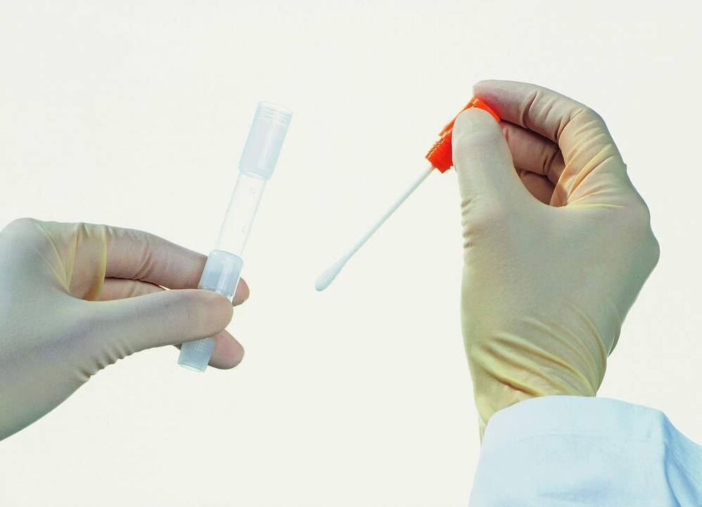 Collection de tests pour détecter la prostatite chronique