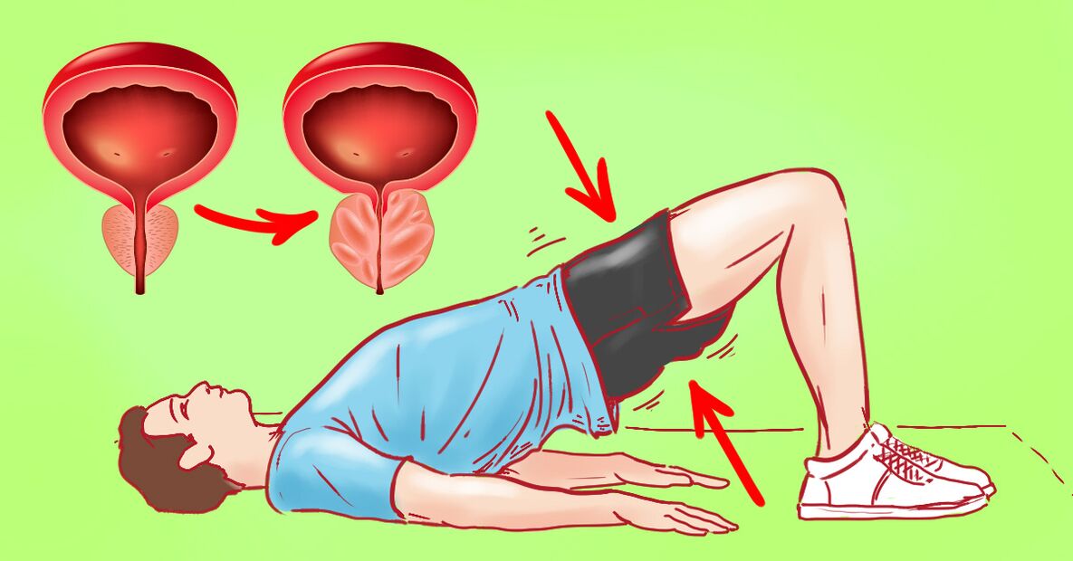Exercices thérapeutiques pour la prostatite chronique